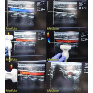 https://www.themedicka.com/10058-111648-thickbox/2010-siemens-acuson-15l8w-ref-28252596-linear-array-ultrasound-transducer-24849.jpg