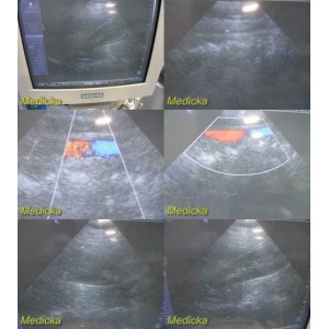 https://www.themedicka.com/10068-111756-thickbox/2007-siemens-ph4-1-sonoline-antares-phased-array-ultrasound-probe-24903.jpg