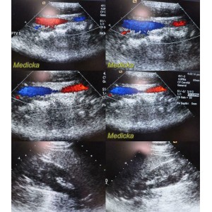 https://www.themedicka.com/10070-111780-thickbox/acuson-4v1-phased-sector-array-ultrasound-transducer-probegood-colorflow24901.jpg