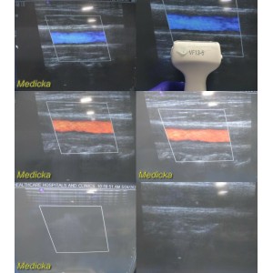 https://www.themedicka.com/10082-111923-thickbox/2006-siemens-vfx13-5-04838848-linear-array-multi-d-ultrasound-probe-24910.jpg