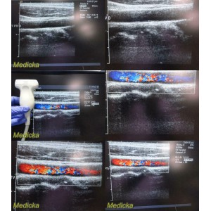 https://www.themedicka.com/10129-112464-thickbox/acuson-model-15l8w-linear-array-ultrasound-transducer-probe-24856.jpg