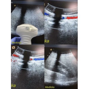 https://www.themedicka.com/10163-112866-thickbox/acuson-6c2-model-08248188-conex-array-ultrasound-transducer-probe-24722.jpg