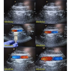 https://www.themedicka.com/10179-113054-thickbox/acuson-8v5-p-n-08241114-sector-array-ultrasound-transducer-probe-24742.jpg