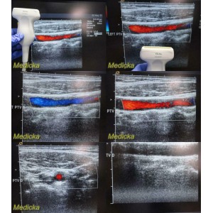 https://www.themedicka.com/10180-113066-thickbox/acuson-linear-array-ultrasound-transducer-probe-model-15l8w-24740.jpg