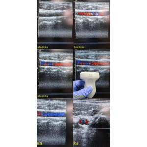 https://www.themedicka.com/10183-113102-thickbox/acuson-15l8w-p-n-08241113-linear-array-ultrasound-transducer-probe-24735.jpg