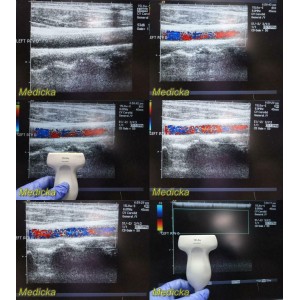 https://www.themedicka.com/10187-113150-thickbox/acuson-15l8w-model-08241113-linear-array-ultrasound-transducer-probe-24810.jpg