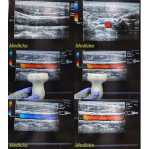 https://www.themedicka.com/10205-113349-thickbox/acuson-15l8w-p-n-08241113-linear-array-ultrasound-probe-good-color-flow-24816.jpg