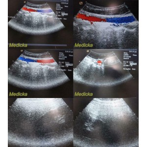 https://www.themedicka.com/10208-113385-thickbox/acuson-8c4-ultrasound-transducer-probe-convex-array-24812.jpg