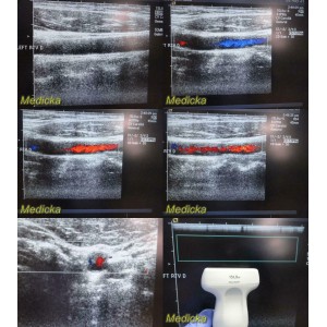 https://www.themedicka.com/10231-113647-thickbox/acuson-15l8w-p-n-08241113-linear-array-ultrasound-transducer-probe-24733.jpg