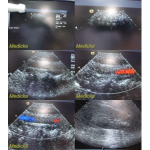 https://www.themedicka.com/10258-113971-thickbox/acuson-3v2c-phased-array-ultrasound-transducer-probe-24758.jpg