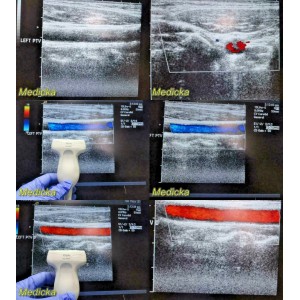 https://www.themedicka.com/10270-114115-thickbox/acuson-15l8w-linear-array-ultrasound-transducer-probe-24774.jpg