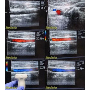 https://www.themedicka.com/10272-114139-thickbox/acuson-15l8w-ultrasound-transducer-probe-linear-array-24770.jpg