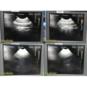 https://www.themedicka.com/10296-114423-thickbox/atl-c8-514r-curved-array-ultrasound-transducer-probe-tested-24671.jpg