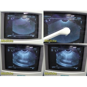 https://www.themedicka.com/10514-116940-thickbox/2009-siemens-ev9-4-p-n-08647500-endocavity-ultrasound-transducer-probe-25516.jpg