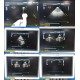 Philips IE33 Diagnostics Ultrasound System W/ X7-2 & L15-710 Transducers ~ 26261