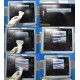 GE LogiQ 9 Diagnostic Ultrasound System W/ 9L, 4C, M7C & E8C Transducers ~ 26345