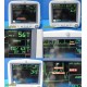 GE Dash 4000 Series Multi-parameter Patient Monitor W/ ECG & NBP Leads ~ 26557