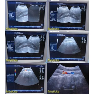 https://www.themedicka.com/13684-153243-thickbox/ge-ref-2050357-model-35c-convex-array-ultrasound-transducer-probe-24350.jpg