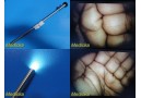 Endolap T2000.00 Millennium 10mmx0° Rigid Telescope, Laparoscope ~ 28338