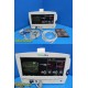 WA Protocol Inc 62000 Series Patient Monitor W/ ECG, SpO2 & NBP Leads ~ 28412