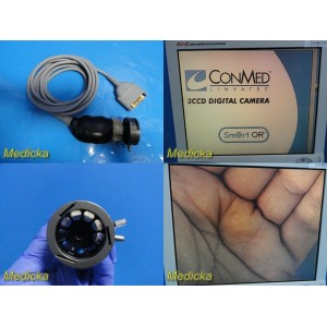 https://www.themedicka.com/14603-163826-thickbox/conmed-linvatec-im3330-3ccd-endoscopy-camera-headcoupler-excellent-img24045.jpg