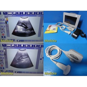 https://www.themedicka.com/15219-170978-thickbox/bard-site-rite-vision-9770032-portable-ultrasound-w-9770035-convex-probe-29286.jpg