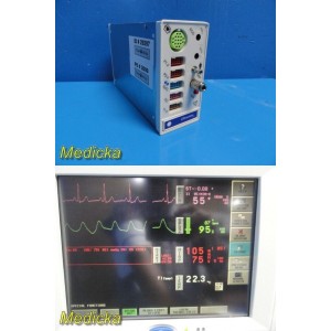 https://www.themedicka.com/15251-171369-thickbox/spacelabs-91496-ultraview-sl-multiparameter-module-options-icehrsu-29297.jpg