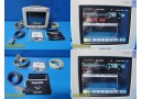 2015 Philips Intellivue MP5SC Ref M8105AS Patient Monitor W/ NBP,SpO2 Lead~29797