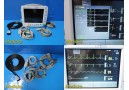 GE Datex Ohmeda S5/FM Patient Monitor W/ NBP,SpO2, ECG Leads, MMS Module ~ 30514