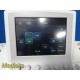 Philips IU22 Diagnostic Ultrasound System Console (Breast, Thyroid, MSK) ~ 30263