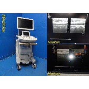 https://www.themedicka.com/16115-185118-thickbox/philips-iu22-diagnostic-ultrasound-system-console-breast-thyroid-msk-30263.jpg