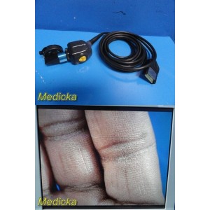 https://www.themedicka.com/16474-191649-thickbox/smith-nephew-560h-hd-camera-head-72200561-w-72201699-urology-coupler-30373.jpg