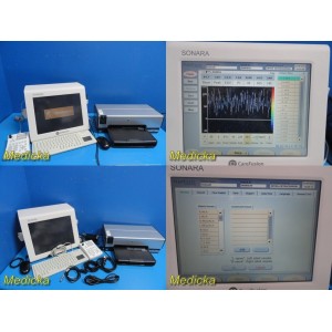 https://www.themedicka.com/16559-192901-thickbox/carefusion-natus-neurology-sonara-tcd-w-20mhz-probe-remote-printer-30406.jpg