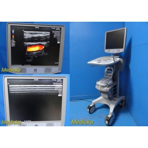 https://www.themedicka.com/16887-198976-thickbox/2014-zonare-zone-scan-engine-w-smart-cart-sony-up-897-printerl14-5-probe31160.jpg