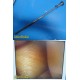 ACMI Rigid Telescope Laparoscope, 10mmx0°, Working Length: 31 cm ~ 31602