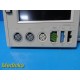 GE 120 Series Maternal Fetal Monitor W/ 1X US & Toco Transducer, 2X Leads ~32305