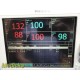 Philips VS3 Sure Signs 863074 Spot Vitals Monitor W/ Leads & Stand ~ 33831