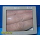 National Display System V3C-SX18-A173 18" Medical Display Monitor ONLY ~ 33773