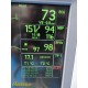 GE Dash 4000 MULTI-PARA MONITOR, CO2 IBP NBP ECG TEMP Masimo SPO2 & Print~ 34054