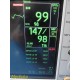 GE Dash 3000 (NBP,Temp,SpO2,ECG & Print) Patient Monitor W/ Patient Leads ~34223