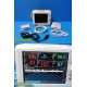 Philips VS3 SureSigns 863073 Spot Vitals Monitor W/ (NBP,SPO2,TEMP) Leads ~34218