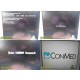 Conmed DRSHD 1080P High Definition Image Manager Console *FOR PARTS* ~ 34597