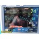 GE Dash 5000 Patient Monitor (IPB NBP ECG SpO2 TEMP CO CO2) W/ New Leads ~ 34303