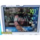 GE Dash 5000 Patient Monitor (IPB NBP ECG SpO2 TEMP CO CO2) W/ New Leads ~ 34303