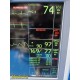 GE Dash 5000 Monitor (IPB, NBP, ECG, SpO2, TEMP) W/ NEW Patient Leads ~ 34309