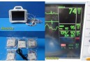 GE Patient Monitor Dash 3000 (NBP,Temp,SpO2,ECG & Print) &Accessory Leads~34310