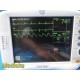 GE Patient Monitor Dash 3000 (NBP,Temp,SpO2,ECG & Print) &Accessory Leads~34310