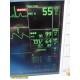 GE Dash 3000 Series Patient Monitor (SpO2 Masimo CO/T EKG NBP), NEW Leads~34499