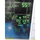 GE Dash 3000 Series Patient Monitor (SpO2 Masimo CO/T EKG NBP), NEW Leads~34499