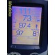 Welch Allyn 45NTO Spot Vital Signs LXI Monitor W/ Leads (TEMP, NBP, SPO2) ~34916